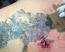 Осколок прошел сквозь вытатуированный на плече Крым: защитник из Мариуполя поделился щемящей фотографией
