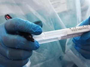 В Украине изменили подход к тестированию на коронавирус: кому будут проводить исследования?